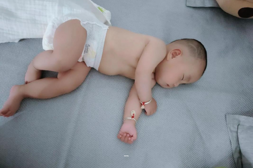 陵水宝宝脸上有白色斑块